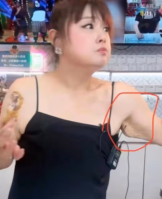 首演綜藝!陳嘉佳減重上百斤後人氣急升,卻因皮膚松垮被指嚇人