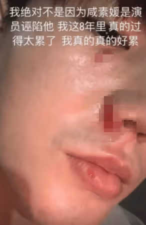 韓女星遭爆「家暴小18歲夫」！臉上見血：這8年太累了　後續反轉網看傻