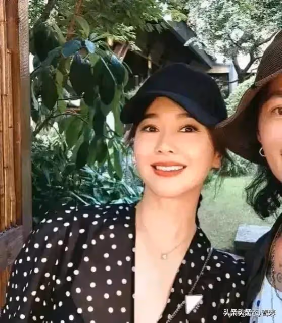 46歲左小青醫美後皺紋全無，臉部腫成了「發麵饅頭」，科技狠活真是害人不淺！