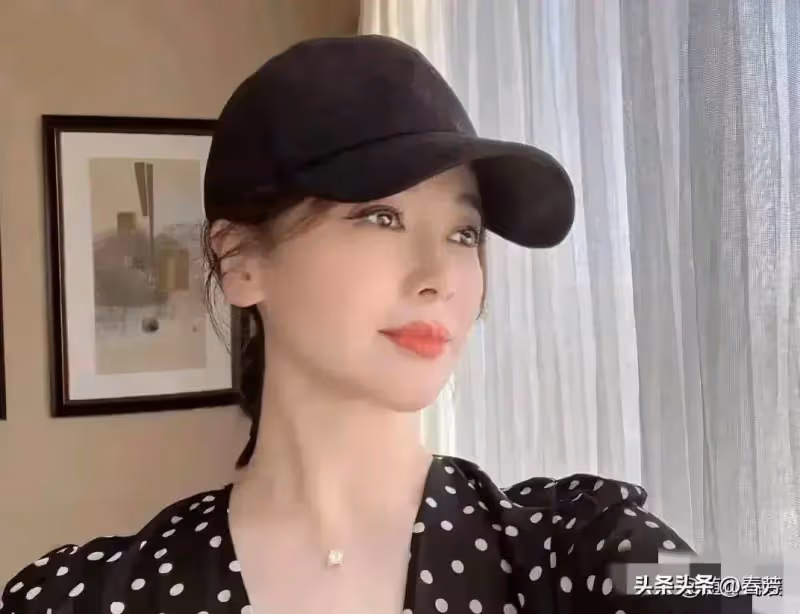 46歲左小青醫美後皺紋全無,臉部腫成了「發麵饅頭」,科技狠活真是害人不淺!