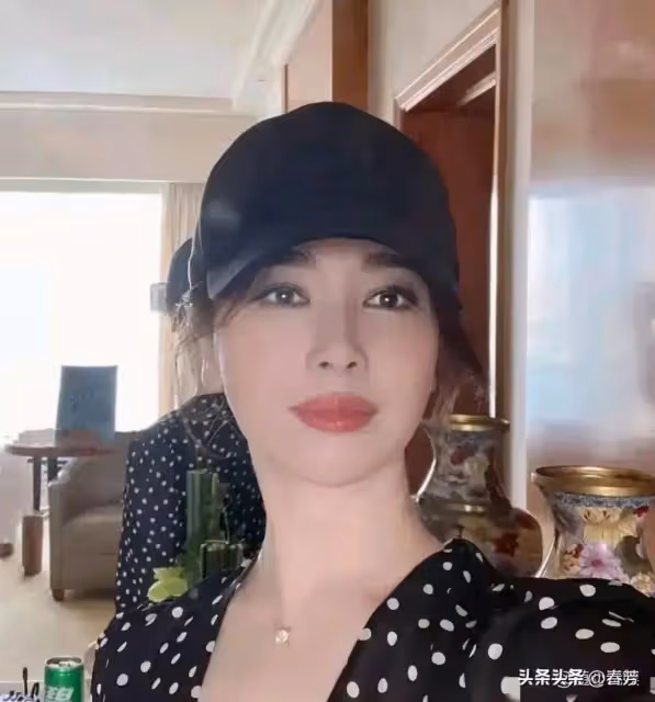 46歲左小青醫美後皺紋全無,臉部腫成了「發麵饅頭」,科技狠活真是害人不淺!