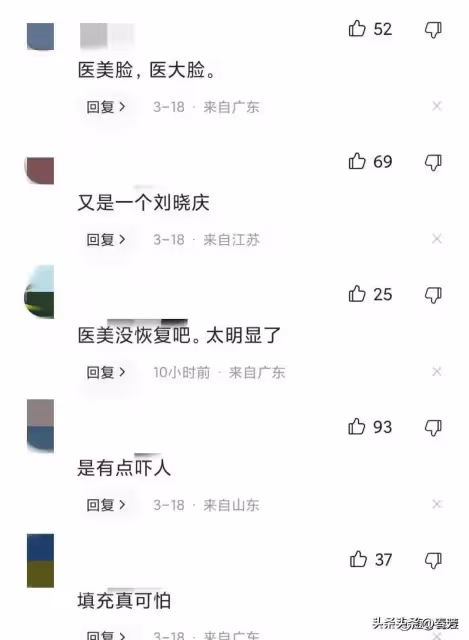 46歲左小青醫美後皺紋全無,臉部腫成了「發麵饅頭」,科技狠活真是害人不淺!