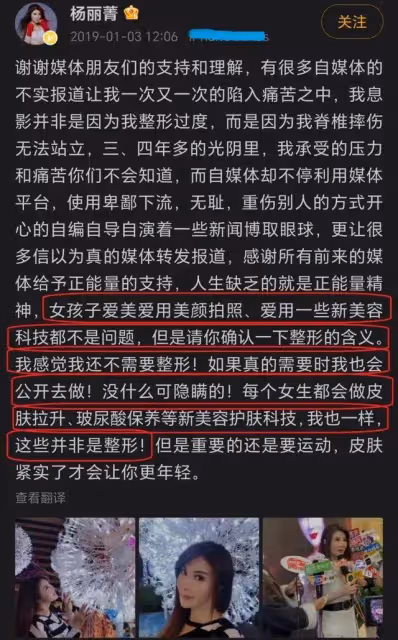 楊麗菁顏值崩塌被嘲像劉曉慶！昔日她性感火辣情路坎坷