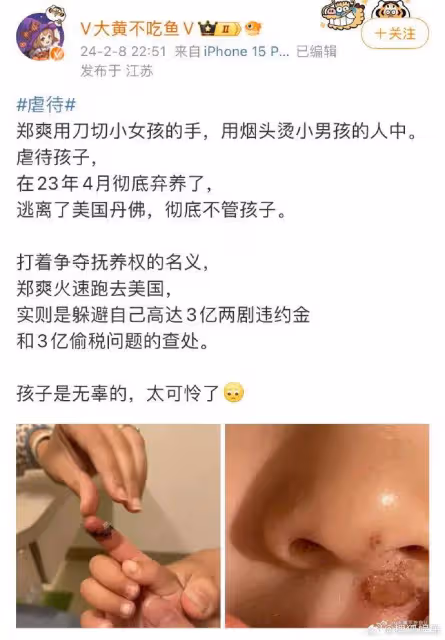 鄭爽被曝再次棄養孩子,用菸頭燙小男孩的人中
