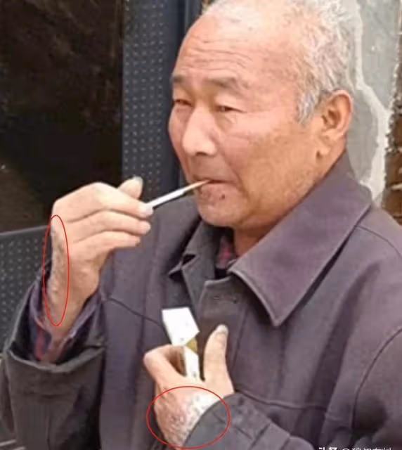 「大衣哥」門口老頭蹲守真相揭曉：身患疾病欲借錢，卻被村民指責