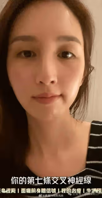 35歲前港姐重提TVB年代曾嚴重脫髮！一星期輕10磅近年才重拾健康
