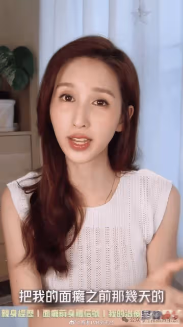 35歲前港姐重提TVB年代曾嚴重脫髮！一星期輕10磅近年才重拾健康