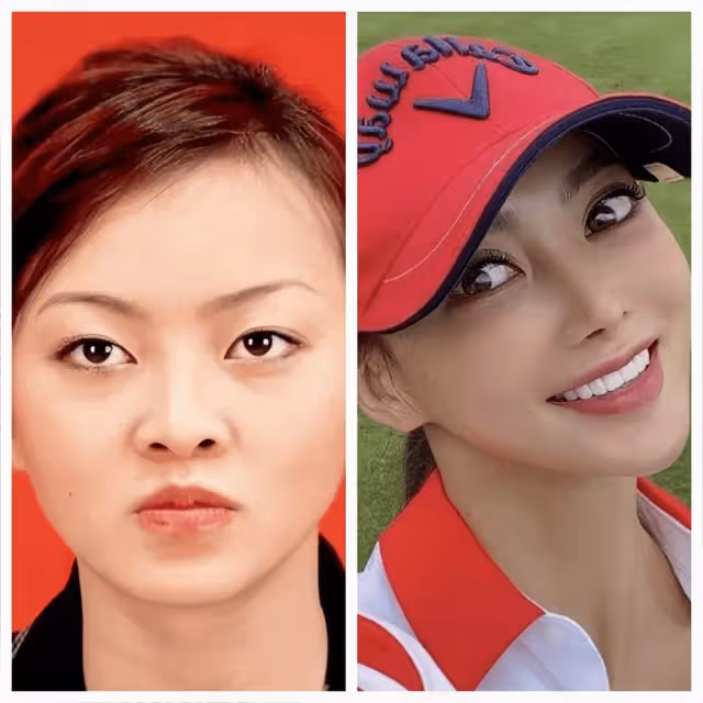 香港知名男星前妻整容成癮，下巴直接變錐子，越來越像真人芭比