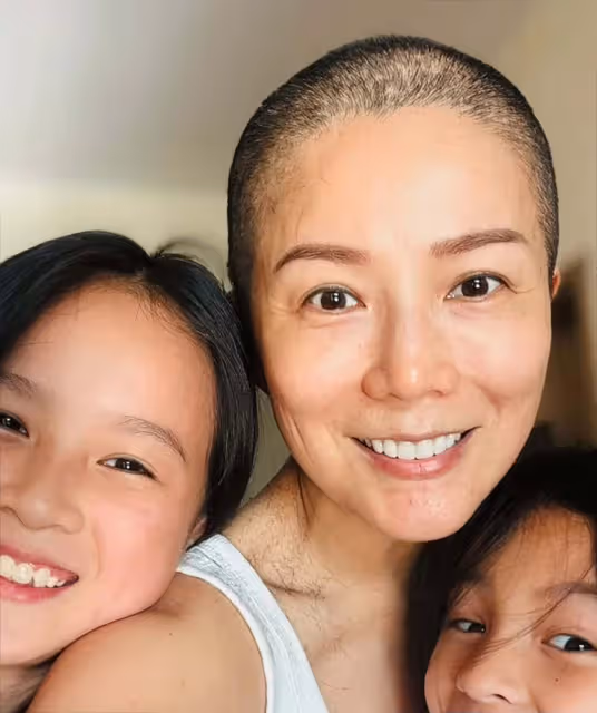香港知名女星乳癌復發，化療後掉發剃成光頭，已準備好多頂假髮