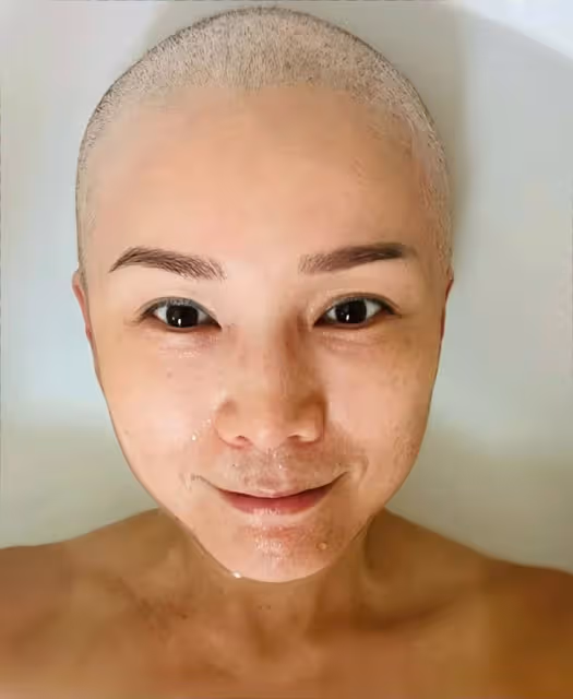 香港知名女星乳癌復發,化療後掉發剃成光頭,已準備好多頂假髮