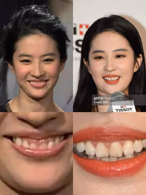 看了劉亦菲生圖就不焦慮了!富態頸紋雙下巴,仙女也靠修圖輸出
