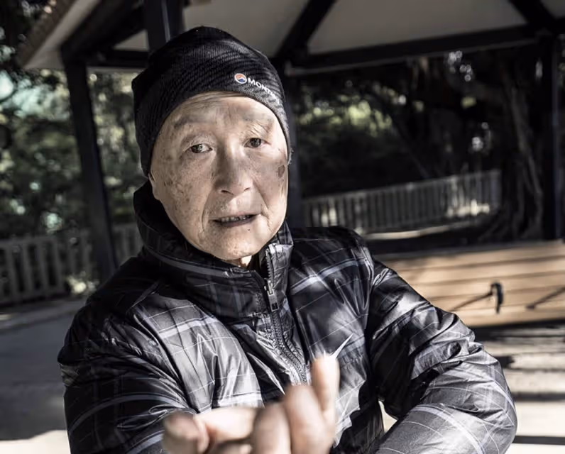 TVB知名老戲骨因天皰瘡離世,全身潰爛痛不欲生,日花千元洗傷口