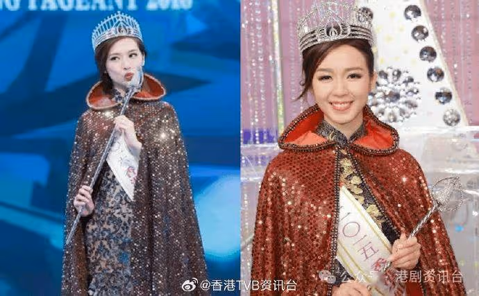 TVB港姐冠軍「豬膽鼻」消失!坦承純天然靠化妝