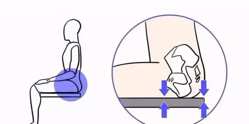 女生的屁股上,為什麼會有兩坨「黑印」?帶你揭開真相