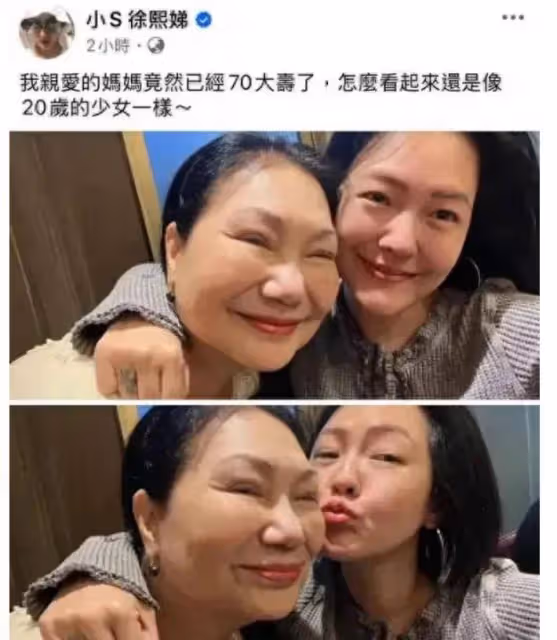 48歲大S終於露面,身材發福頭頂斑禿狀態差,30度大熱天穿長袖