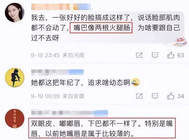 46歲海清疑似整容過度！面部表情僵硬跟劉曉慶神似？