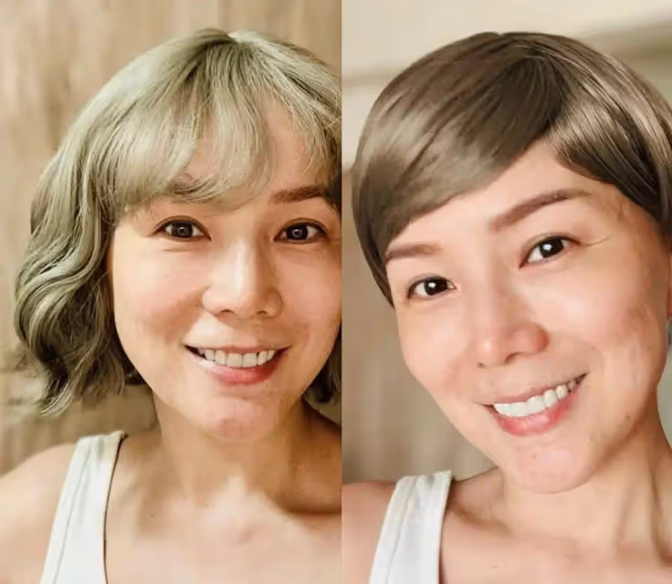 加油!TVB前女星乳癌復發,化療後剃成光頭,將到泰國進行細胞治療
