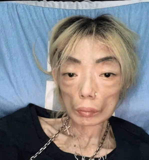 嫁入豪門?8年被折磨成牙齒全掉,不足80斤形似骷髏,慘不忍睹