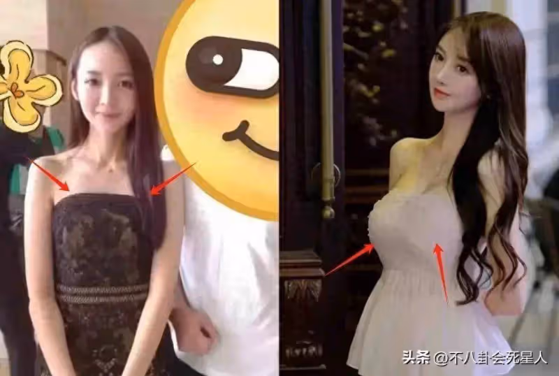 同樣被曝「科技臉」,楊穎和黃曉明女友的不同態度,區別一目了然