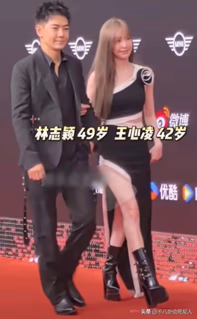 林志穎近照面部僵硬,金晨生圖鼻子歪,明星動臉後遺症都出來了