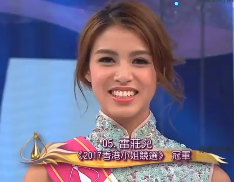TVB「最丑港姐」冠軍再戰選美獲季軍,微整後形象變美,考慮做演員