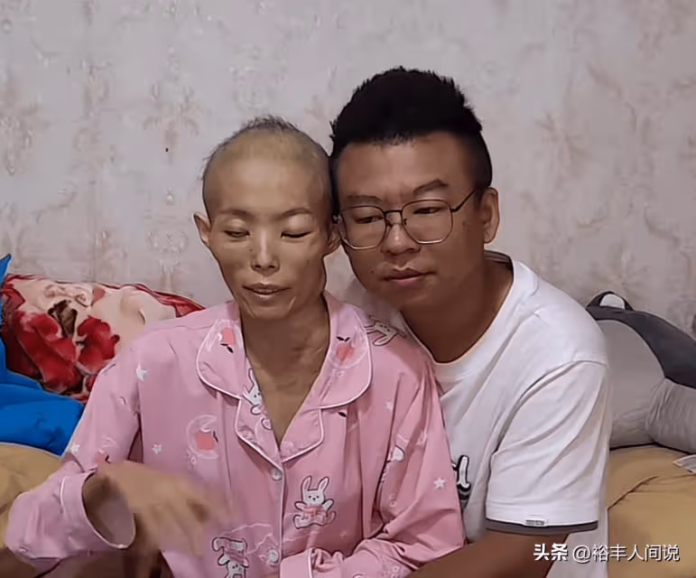 30歲抗癌網紅「寸丫頭」去世,一年瘦到骷髏樣,臨終溫柔撫摸兒子