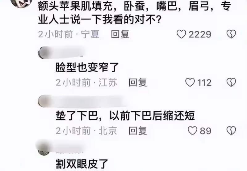 天哪!秦嵐的臉是怎麼了?蘋果肌太飽滿腫的像饅頭!網友:醫美毀了美貌