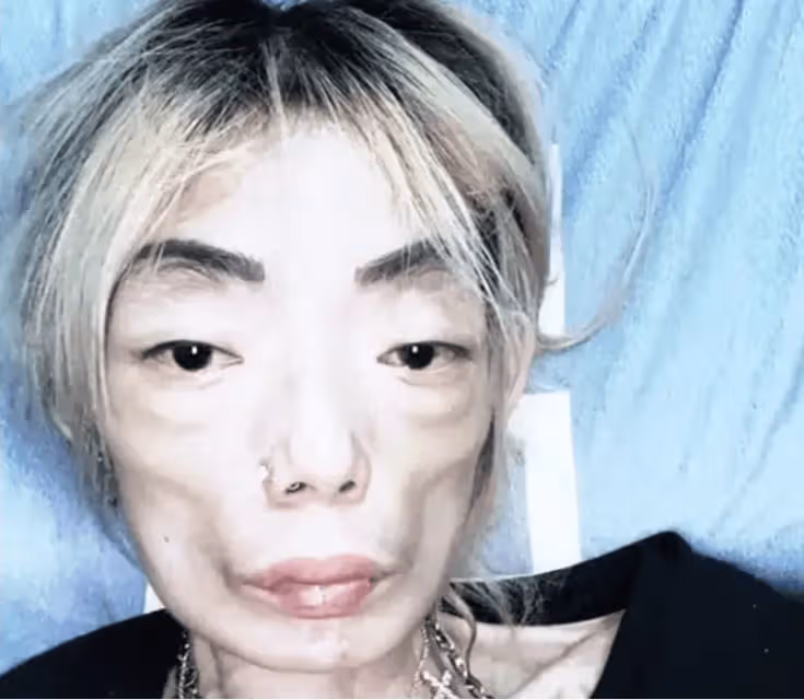 豪門玩物,8年被折磨成牙齒全掉,不足80斤,形似骷髏,慘不忍睹