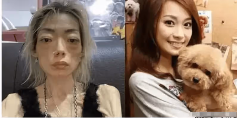 豪門玩物,8年被折磨成牙齒全掉,不足80斤,形似骷髏,慘不忍睹