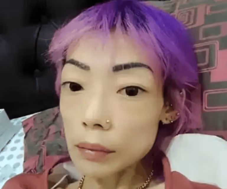 豪門玩物,8年被折磨成牙齒全掉,不足80斤,形似骷髏,慘不忍睹