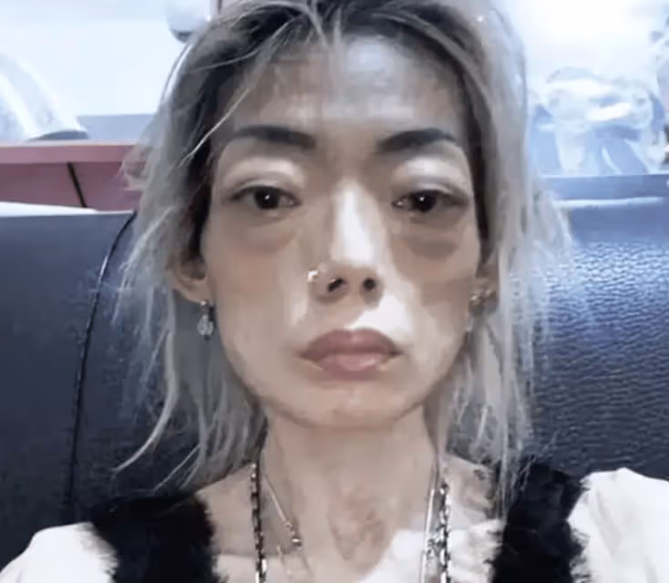 豪門玩物,8年被折磨成牙齒全掉,不足80斤,形似骷髏,慘不忍睹