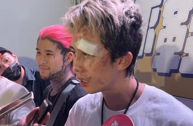 孫安佐被打到滿臉淤青,狄鶯落淚心疼,面對鏡頭仍舊不忘耍帥