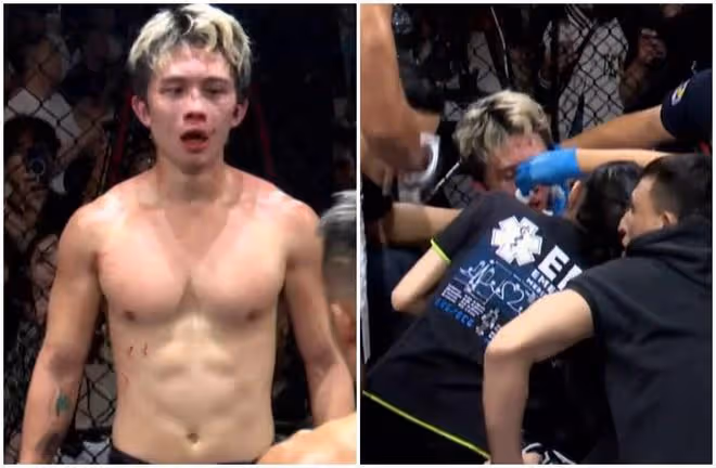 孫安佐被打到滿臉淤青,狄鶯落淚心疼,面對鏡頭仍舊不忘耍帥