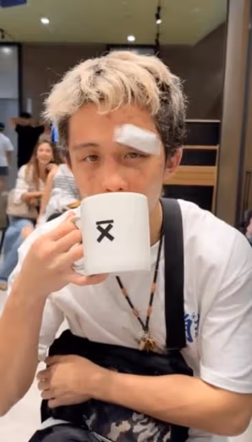 孫安佐被打到滿臉淤青,狄鶯落淚心疼,面對鏡頭仍舊不忘耍帥