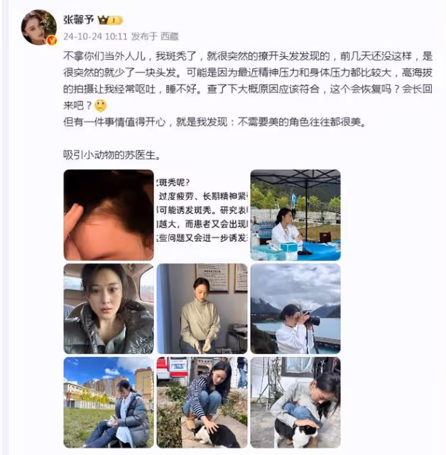 張馨予西藏拍戲出現斑禿,稱經常嘔吐睡不好,精神身體壓力過大
