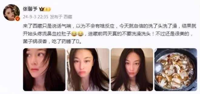 張馨予西藏拍戲出現斑禿，稱經常嘔吐睡不好，精神身體壓力過大