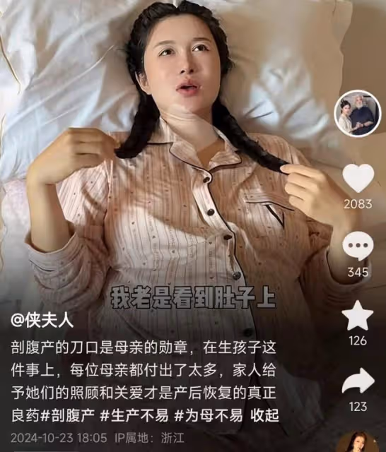 張紀中老婆曬四胎剖腹產傷口,直言刀口是母親的勳章,母愛好偉大