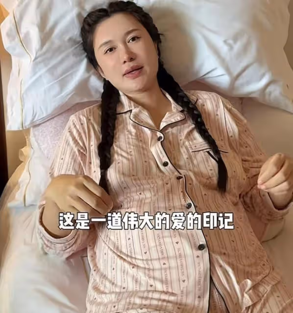 張紀中老婆曬四胎剖腹產傷口，直言刀口是母親的勳章，母愛好偉大