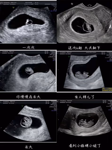 張檬官宣懷孕10周,備孕兩年多終於如願,小腹微凸孕味超足