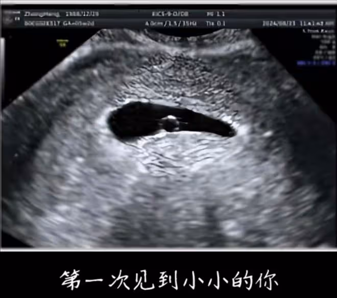 張檬官宣懷孕10周,備孕兩年多終於如願,小腹微凸孕味超足