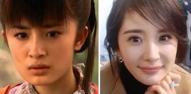 11歲小糯米現身長高太多,顏值完全沒遺傳爸媽基因甚至腺樣體偏大