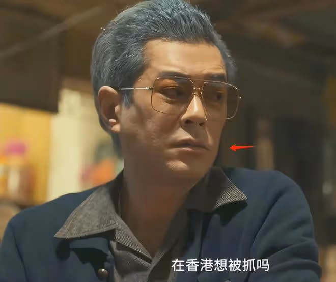 古天樂採訪生圖惹爭議,表情猙獰吊眼角,被指醫美提拉過度出問題
