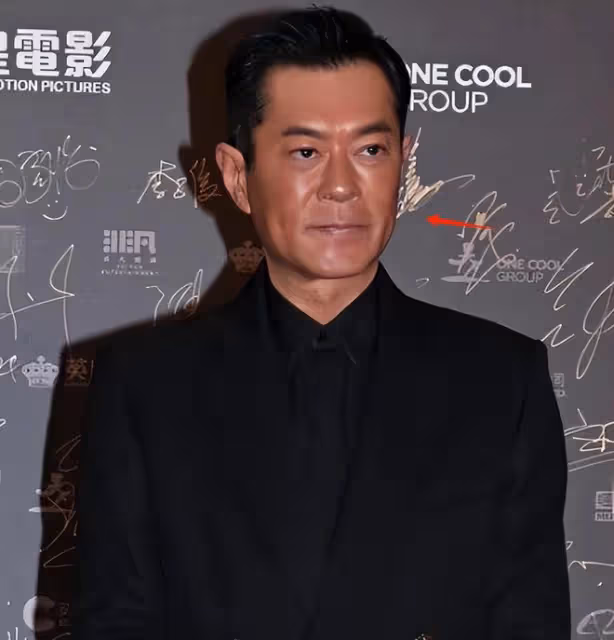 古天樂採訪生圖惹爭議,表情猙獰吊眼角,被指醫美提拉過度出問題