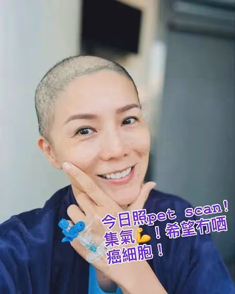 50歲前港姐冠軍患癌因化療苦不堪言,轉新療法情況好轉:感恩賜予第二人生