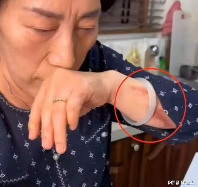 喬任梁父母發聲後受傷照曝光!被詢問後迅速刪除,林更新無奈關評論