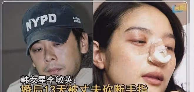「最慘女星」的閃婚經歷堪比恐怖片:新婚13天被丈夫砍斷手指