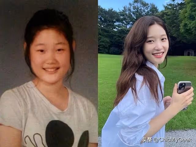 女愛豆大方承認整容,結果超反轉!