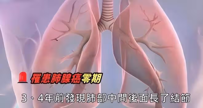 恭喜!劉謙肺腺癌已完全康復,明年將啟動個人魔術巡演