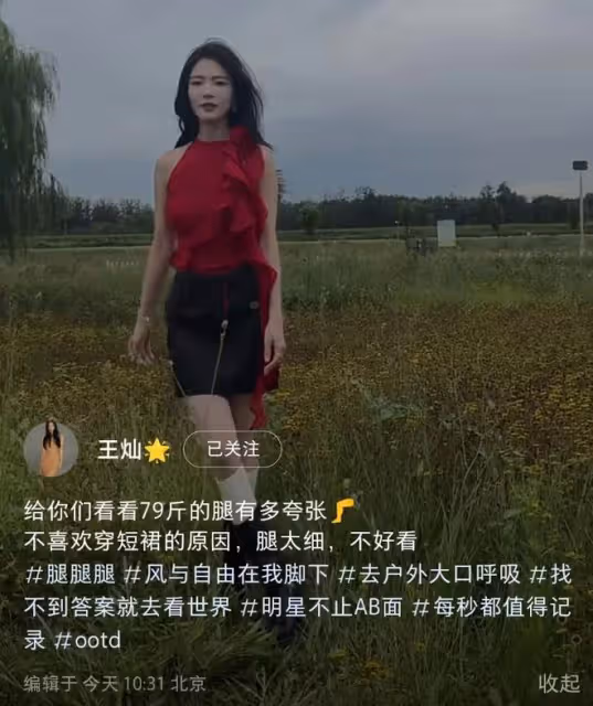 杜淳老婆暴瘦不足80斤,穿短裙瘦成「閃電」,長腿細得像麻杆