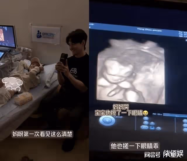 張檬去香港產檢!B超照曝光懷的是男孩,脫鞋測體重拇外翻好嚴重